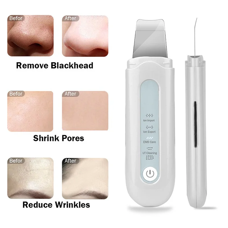 Ultrasonic skin scraper to remove blackheads, acne, dirt, pores, cleansing ems beauty instrument micro-current skin scraper