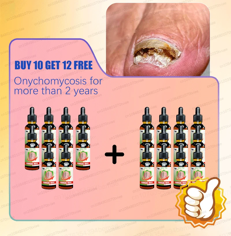 Description Picture 4 of itemEliminate nail problems