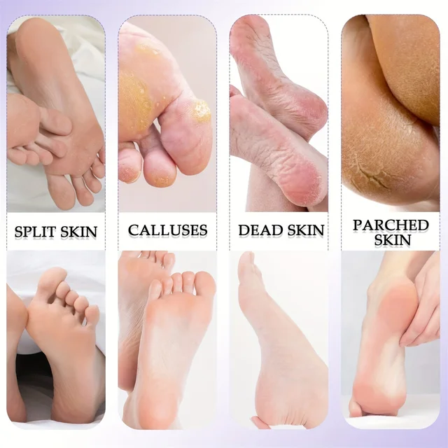 8/10 pezzi Set per pedicure Peeling e esfoliante calli Spazzola per la pulizia dei piedi Pietra per pedali per la cura dei piedi a doppia faccia in acciaio inossidabile 5