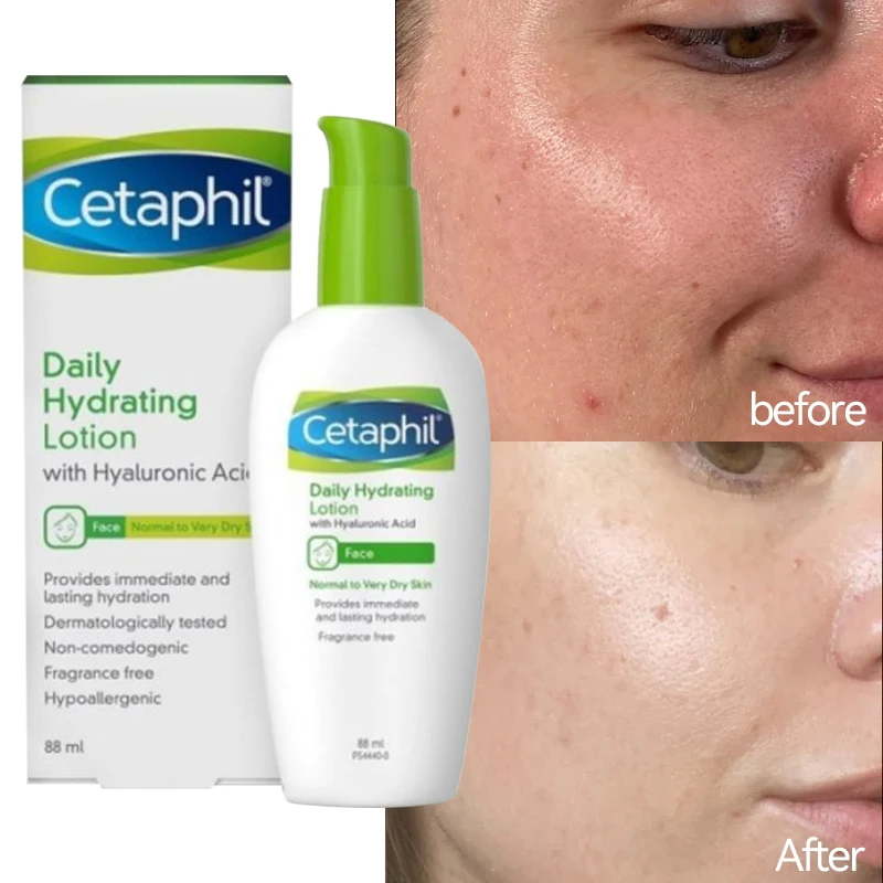 CetaphilHyaluronicAcidHydratingCreamWhiteningMoisturizingCreamNourishingBodyLotion
