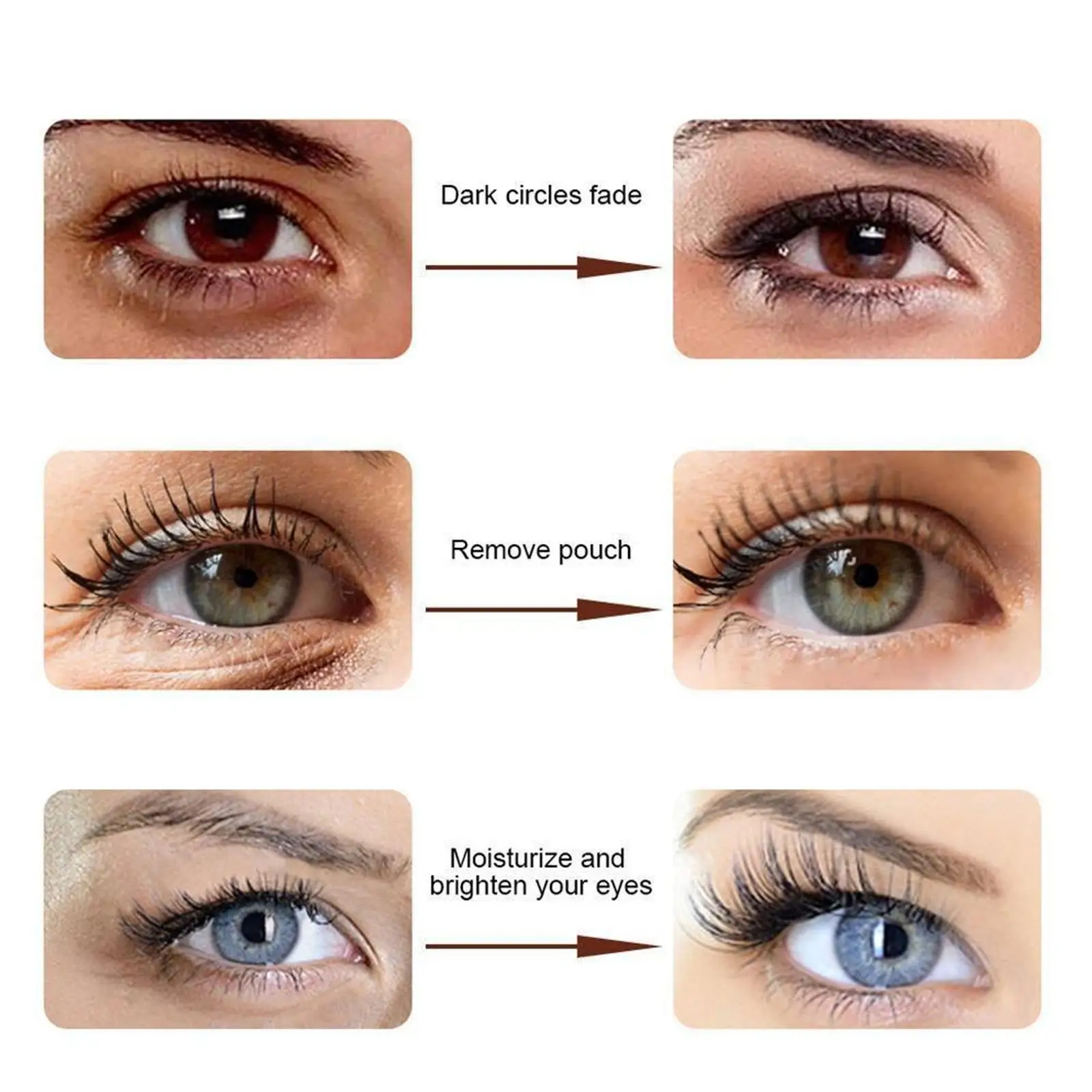 Snake Venom Polypeptide Eye Cream Whitening Dark Circles Removal Fade