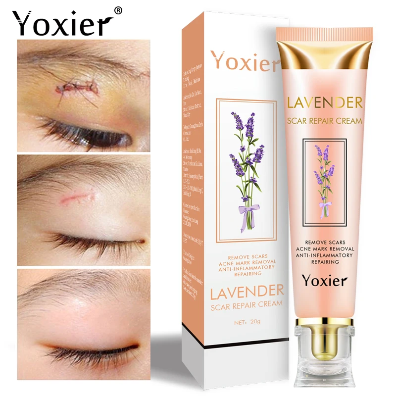 Scar Repair Cream Moisturizing Remove Scars Stretch Marks Pimples Scald