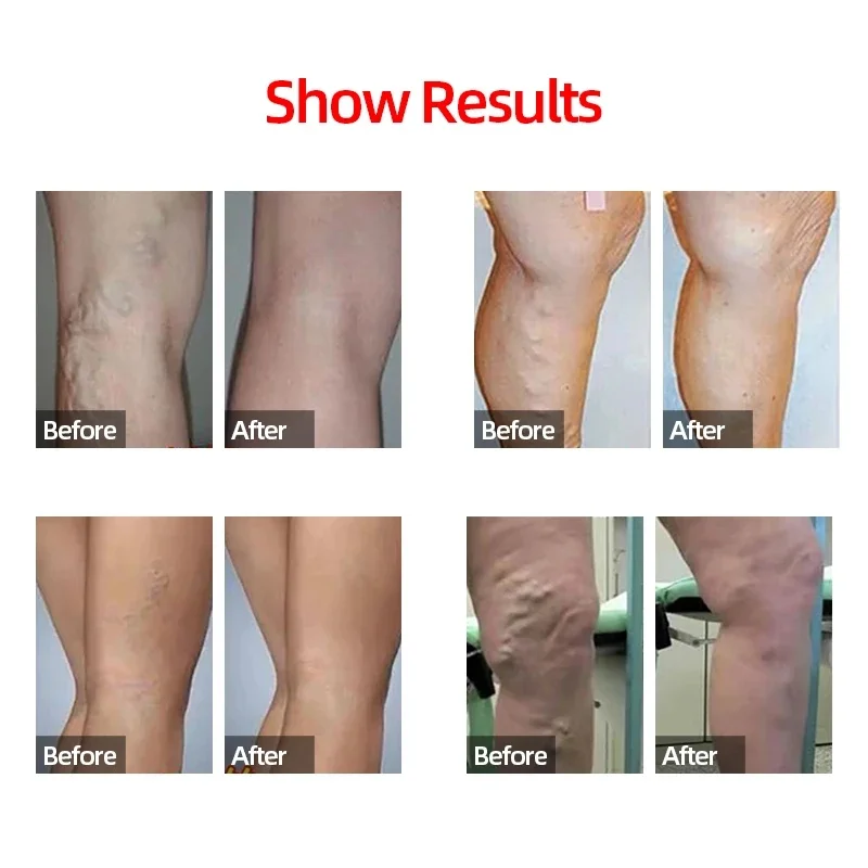 Athlete wearing sleeves during stretching routine