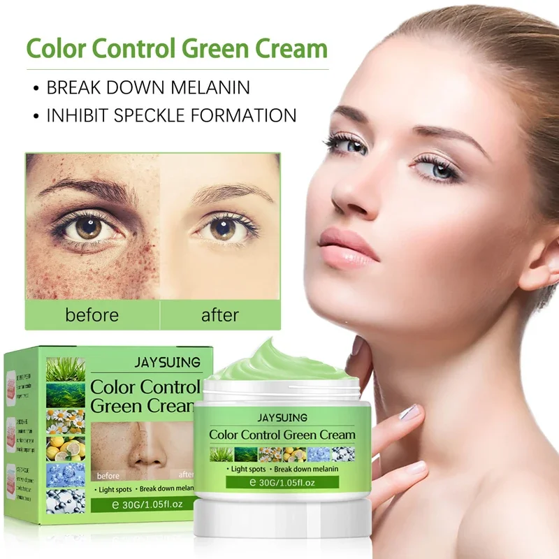 

Nicotinamide Whitening Freckle Cream Remove Melasma Dark Spot Fade Melanin Moisturizer Brighten Anti-aging Beauty Face Skin Care