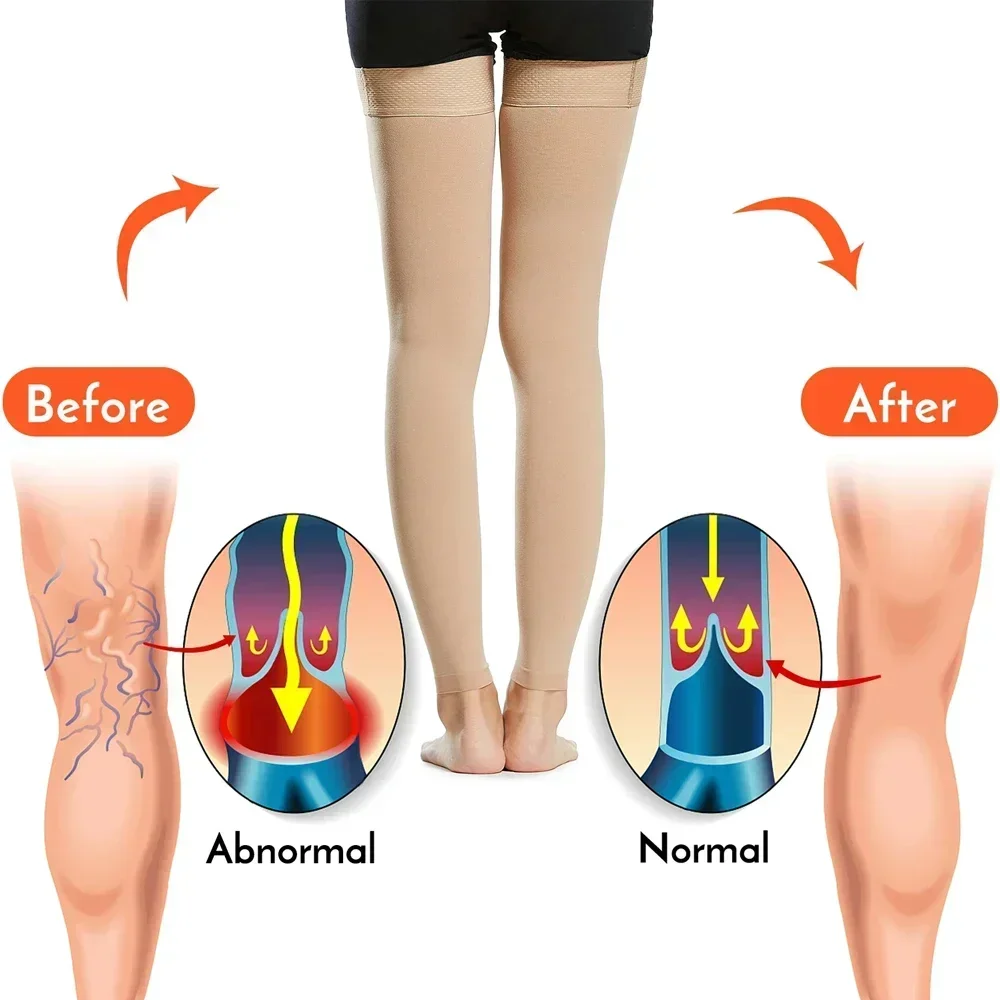 1Pair Thigh High Compression Socks,Firm Support 20-30 mmHg Gradient Compression Stockings with Silicone Band,Treatment for Edema