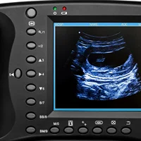 Handheld Ultrasound Machine for Pregnancy Horse & Cows and Other Large Animals - Portable Veterinary Ultrasound Machine 2