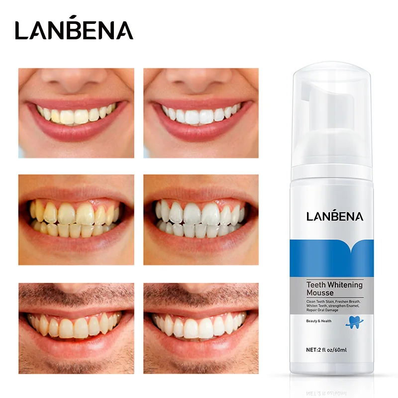 

Зубная паста LANBENA для отбеливания зубов, мусс для чистки зубов, гигиена полости рта, удаление пятен, зубной налет, уход за полостью рта