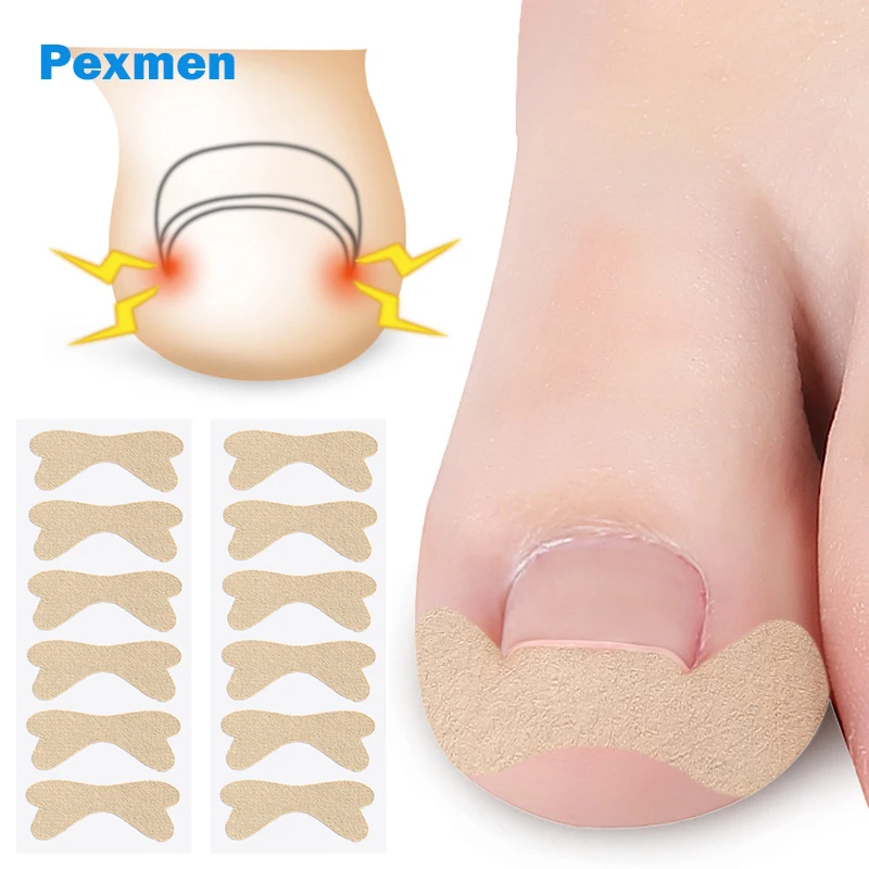 Pexmen 6/12/30Pcs Ingrown Toenail Correction Sticker Adhesive Toenail Patch Toe Nail Treatment Corrector Foot Care Tool