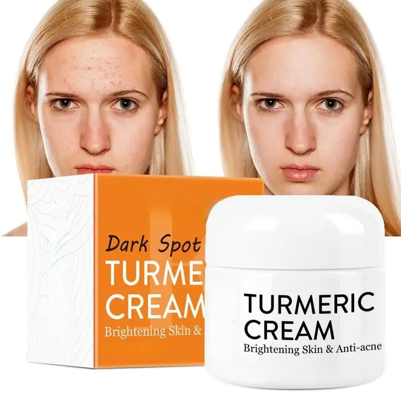 Herb Turmeric Face Cream Repair Acnes Scar Dark Spot Moisturizer Whitening Lightening Against Acne Skin Care