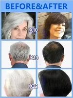 Tueur de cheveux blancs, élimine les cheveux gris et restaure la coloration naturelle des cheveux en 7 jours 2025 4