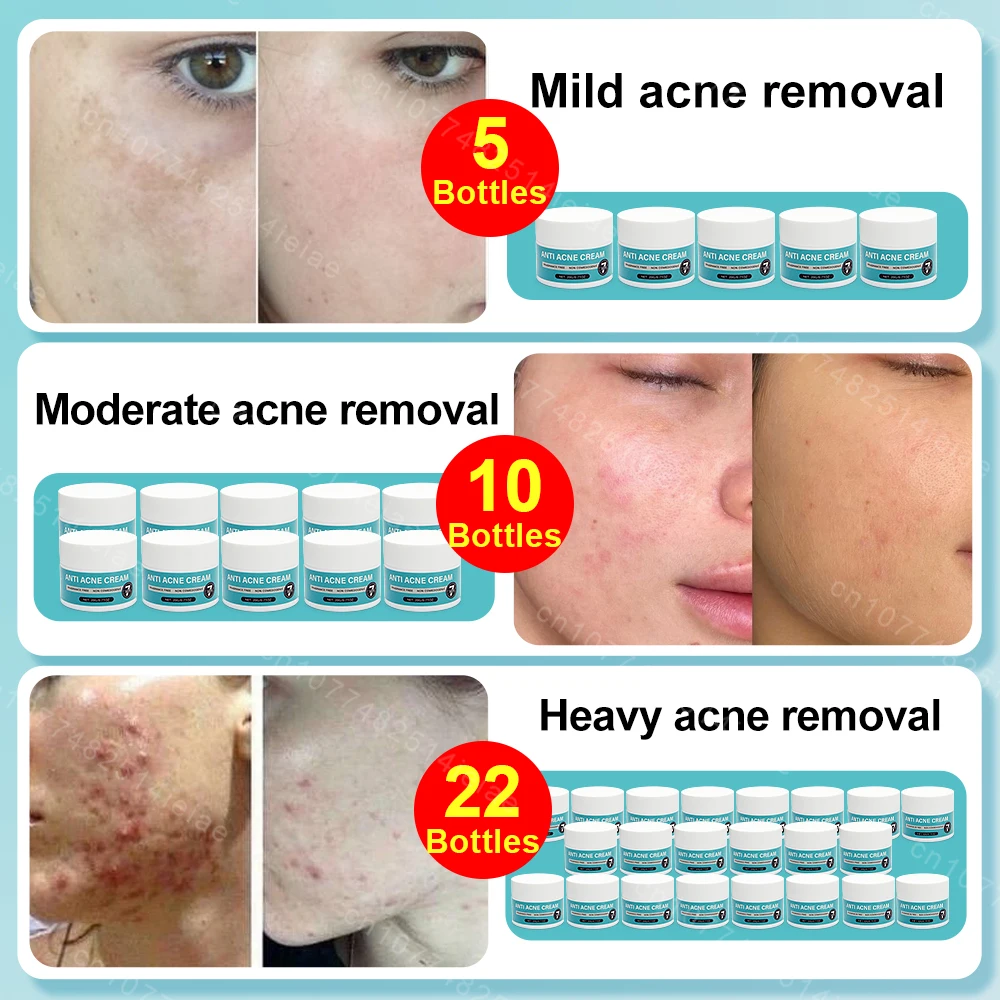 Face Cream Shrink Pores Repair