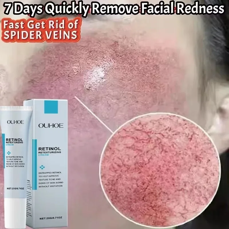 Facial Redness Relief Moisturizing Cream