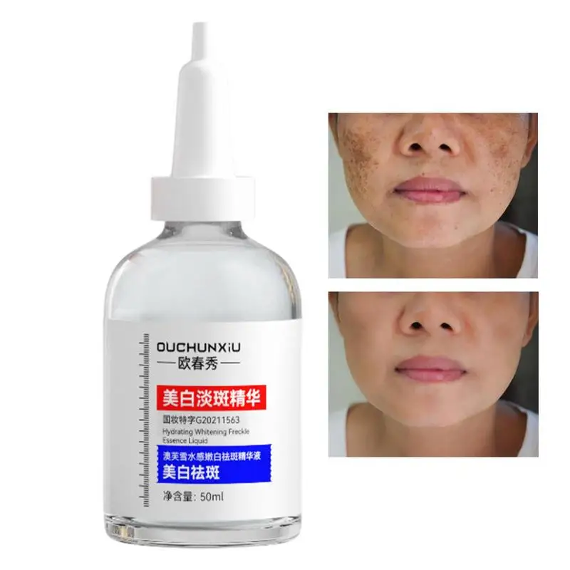 

Dark Spots Correcting Moisturizing Essence 50ml Brightening Anti-Dark Spots Essence Spot Removing Essence For Moisturizing