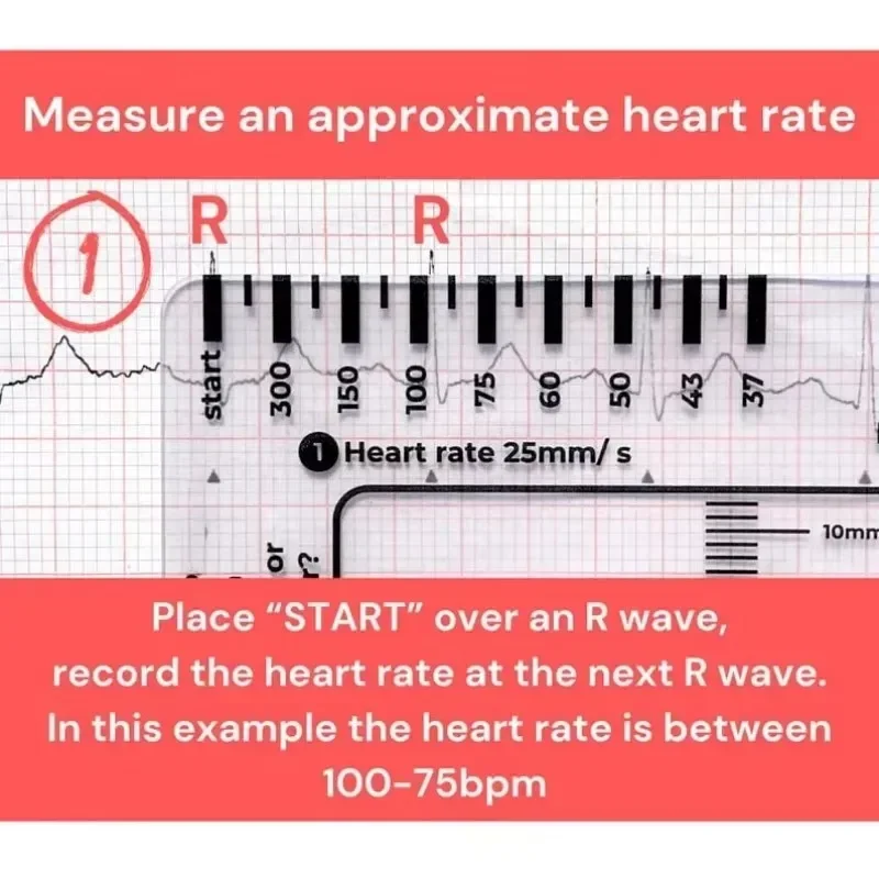 Measurement Tool Ecg 7 Step Ruler 7 Step Scale For Ecg Observation Portable Transparent 7step Ruler Measurement Tool For Interpretation