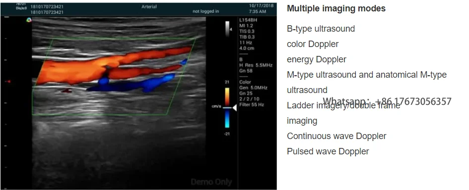 Рисунок 3 - Тест на беременность для собак