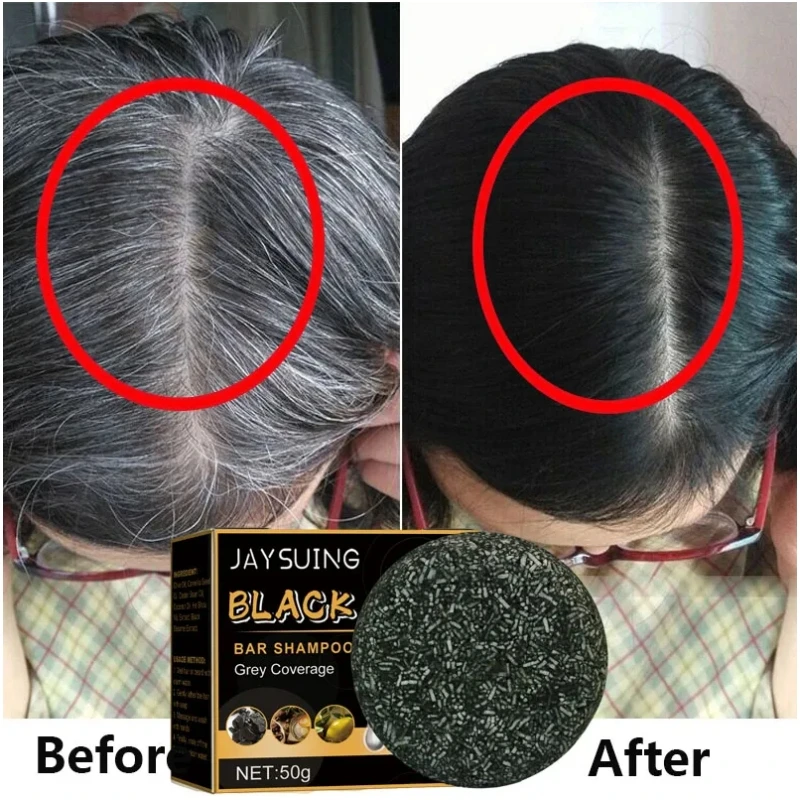

Effective White Hair Treatment Shampoo Bar Anti Gray Color Remedy Darken Hair Scalp Fast Regrowth Soap Anti-Loss Care Men Women