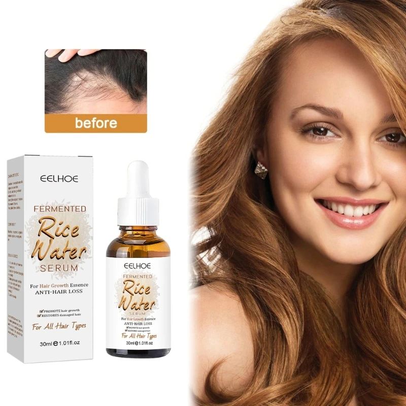 

Эфирное масло Q1QD питает корни волос, уплотняет волосы, восстанавливает раздвоенные волосы