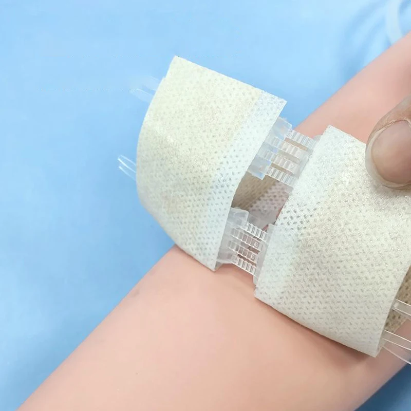 Portable Zipper Tie Wound Closure Patch Hemostatic Patch Wound Fast Without Suture