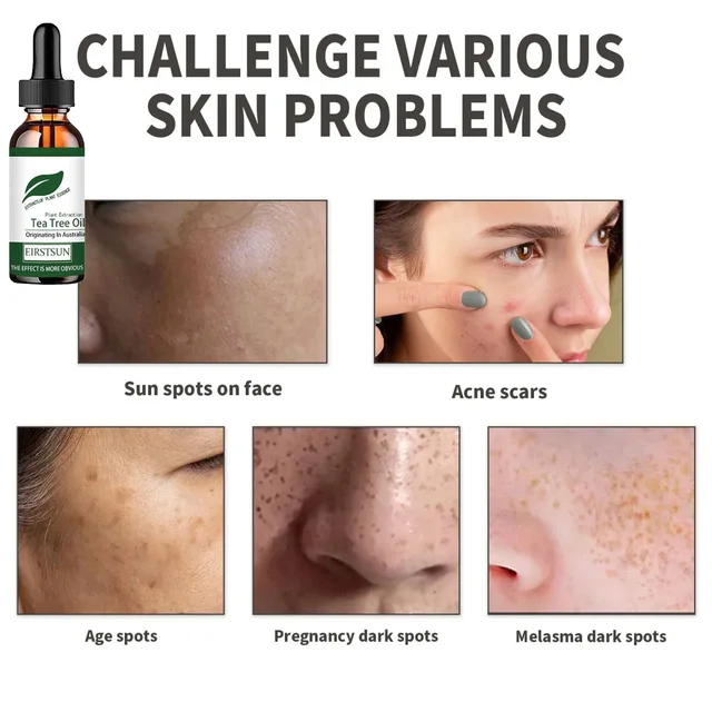 Pure Tea Tree Oil Moisturizer