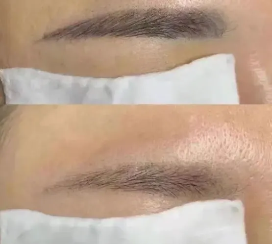 Newest 7 in1 Smart Ice Blue Hydro Dermabrasion Skin Management System Multifunction Facial Beauty Machine For Deep Cleaning Skin photo review