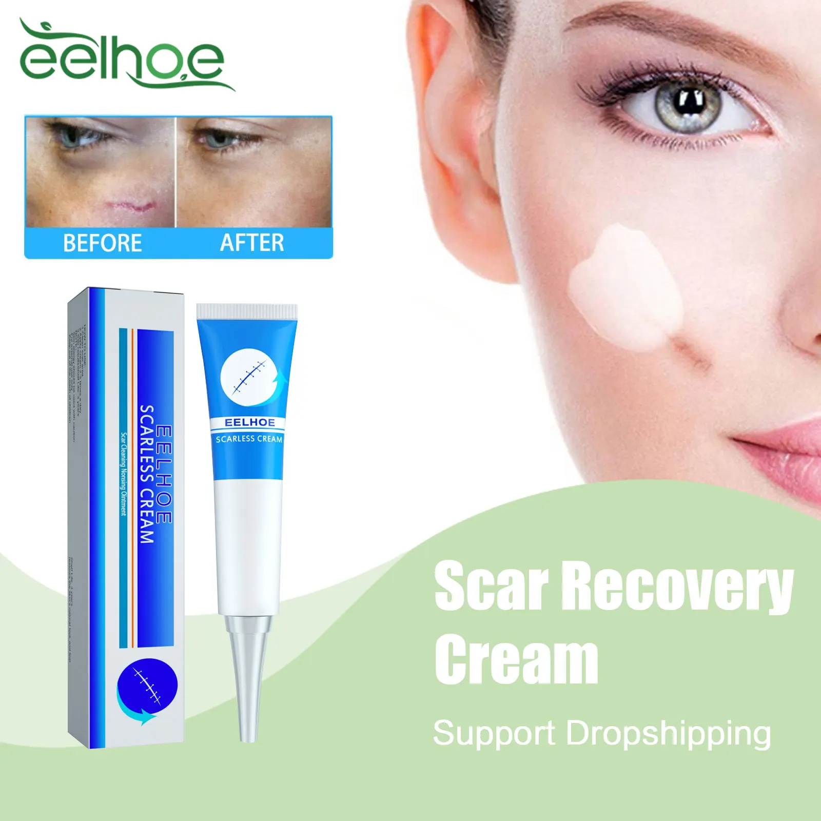 

Scar Recovery Cream Fade Stretch Marks Surgery Scald Scars Treat Acne Spot Skin Repair Moisturizing Smoothening Burn Scar Cream