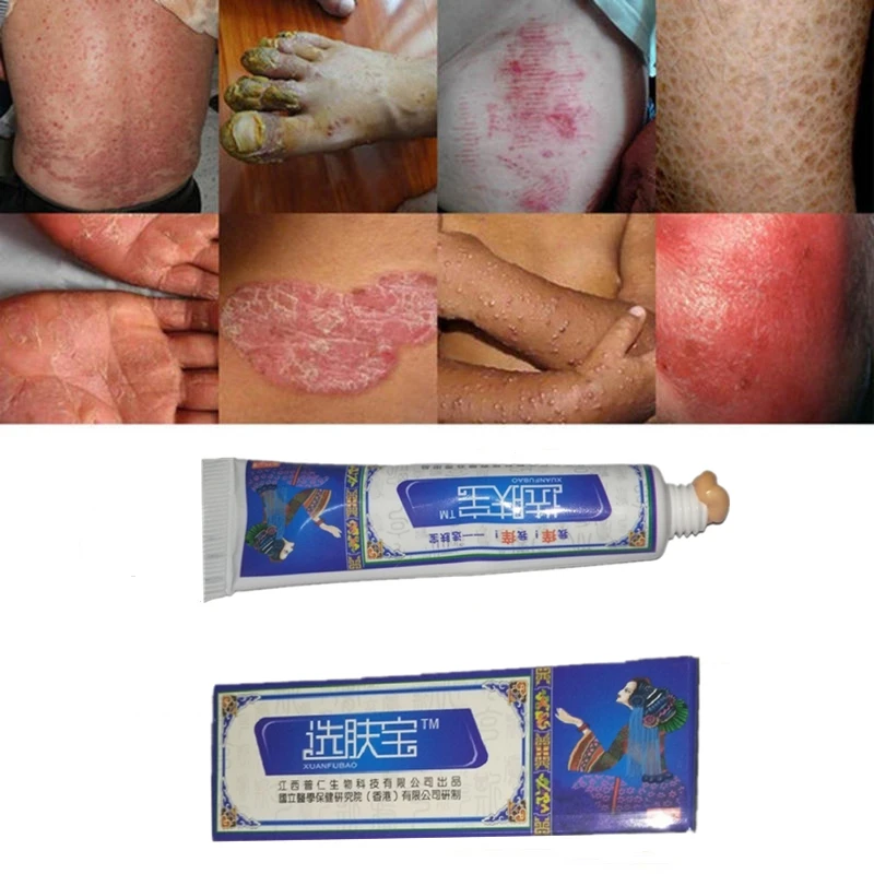 Antibacterial Psoriasis Cream Herbal Effective Anti-itch Relief Dermatitis Eczema Treatment Urticaria Desquamation Skin Care