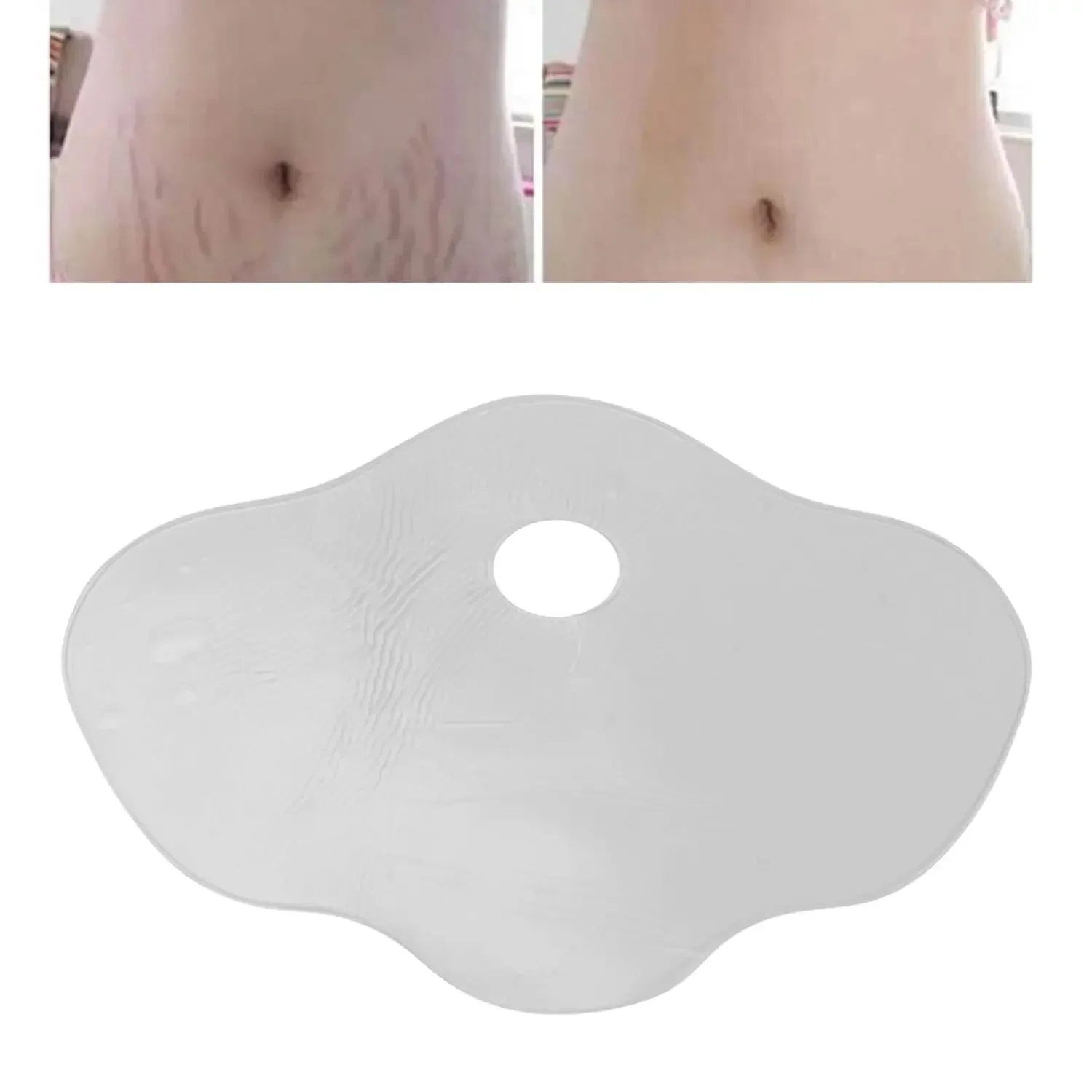 Belly Silicone Pad Anti Wrinkle Scar Stretch Marks Removal Sheets Reusable for Women Abdomen Belly Stomach Pads Stickers belly silicone pad