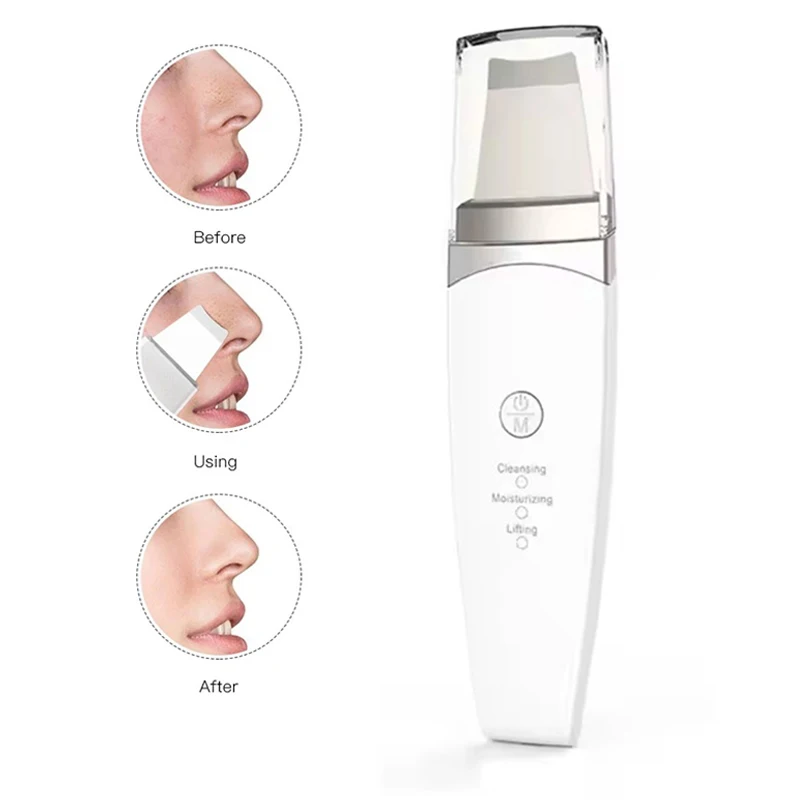 New Facial Ultrasonic Skin Scrubber Spatula Deep Face Cleaning Blackhead Remover Face Lift Machine Peeling Shovel Pore Cleaner