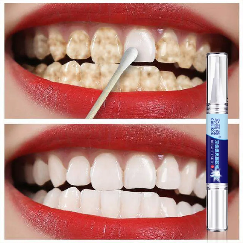 Teeth Whitening Toothpaste Serum Pen Remove Plaque Stains Oral Hygiene Cleaning Dental Bleaching Tools Fresh Breath Tooth Care