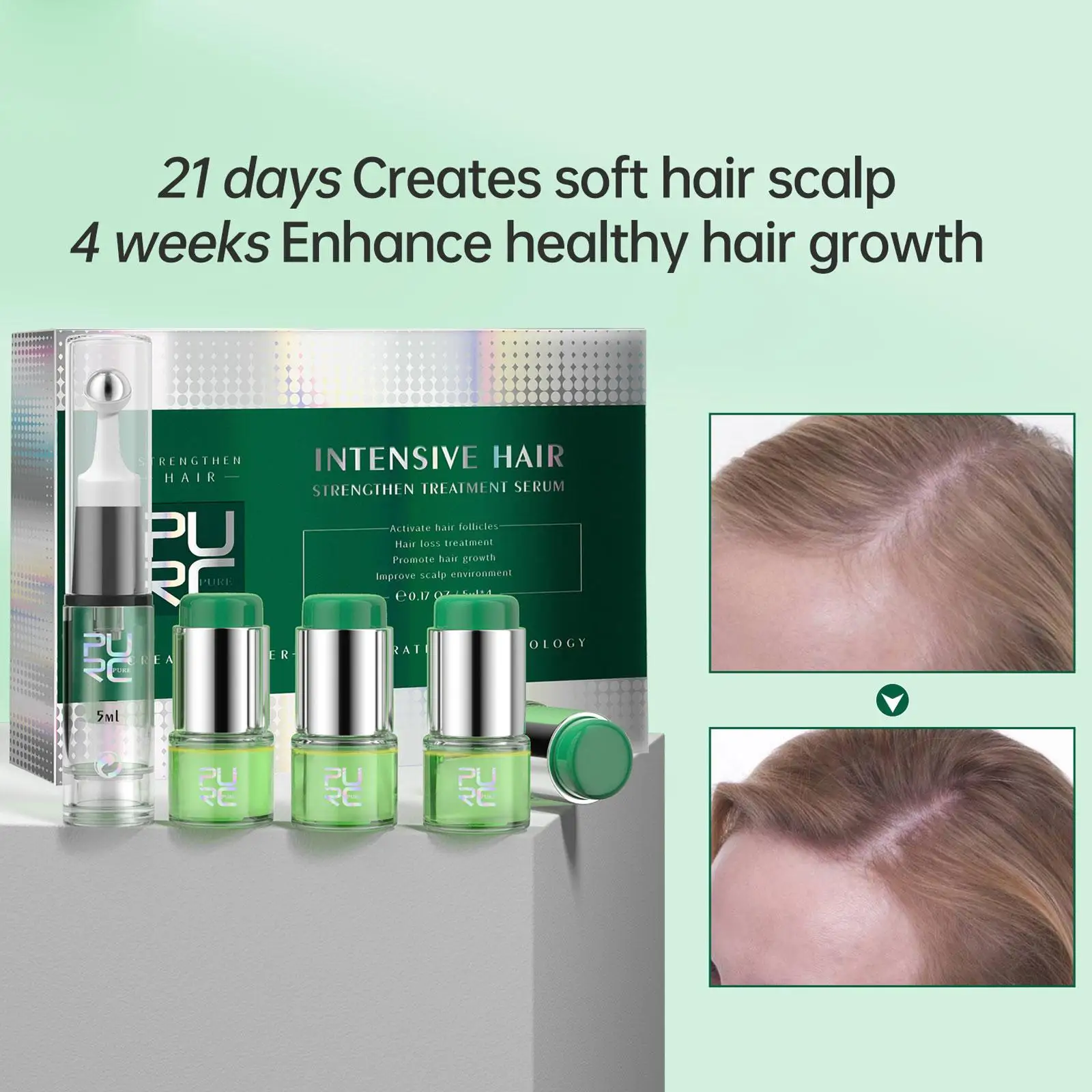 Description Picture 4 of itemProfessional Ginger Products Fast Growing Hair Essential Oil Beauty Hair Care Prevent Hair Loss Oil Scalp Treatment