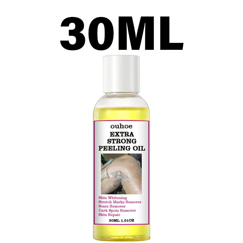 Yellow Orange Green Peeling Oil Gentle Remove Peel Off Dead Skin Exfoliating Body Deep Cleansing Moisturizing Peeling Oil peeling oil