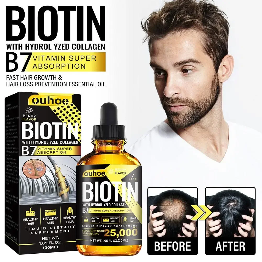 Description Picture 3 of itemProducts Biotin Fast Growing Hair Care Essential Oils Anti Hair Loss Spray Scalp Treatment For Men Women 30ml