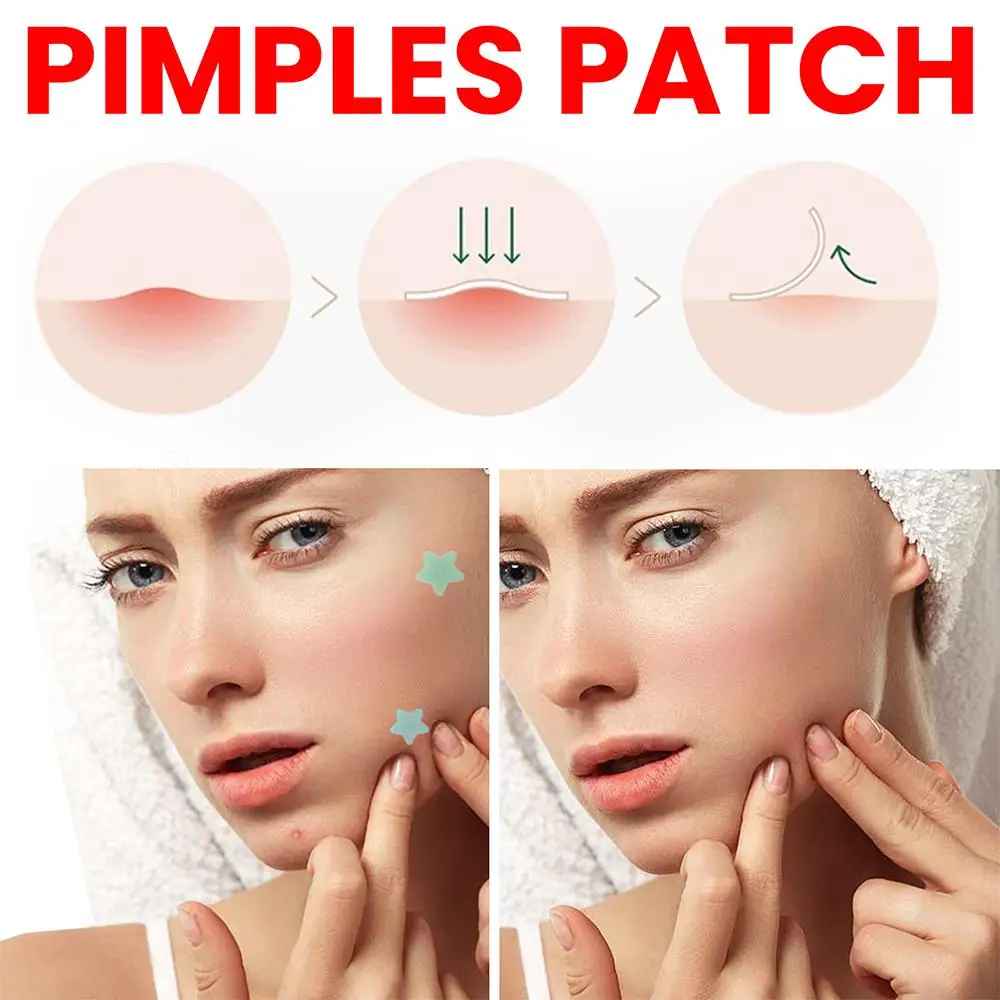 200pcs Star Shape Pimple Patches Colorful Hydrocolloid Pimple Healing Sticker Cute Strong Absorption Zit Patches Face Care 4