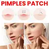 200pcs Star Shape Pimple Patches Colorful Hydrocolloid Pimple Healing Sticker Cute Strong Absorption Zit Patches Face Care 4