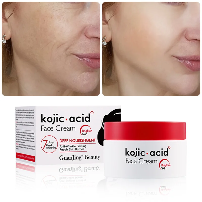 Kojic Acid Retinol Cream Skin Whitening Cream Anti Aging Brighten Fade Stubborn Dark Spots Moisturiz Nourish Facial Skin Care