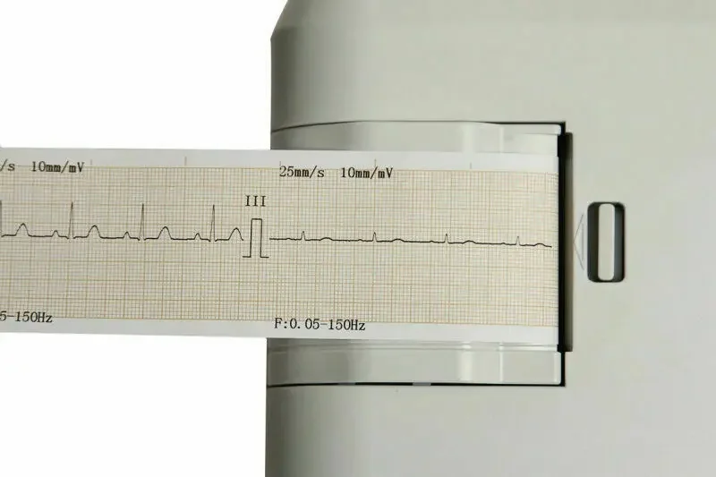 ECG100G ECG Machine Single Channel 12 Leads EKG Monitor CONTEC