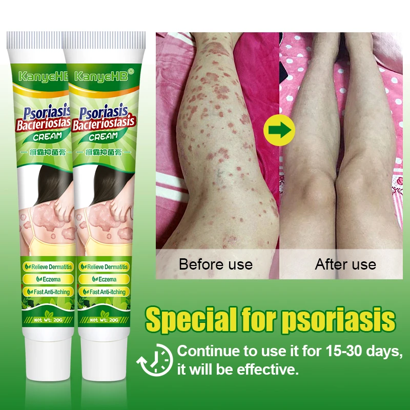 1pcs Private Part Anti-itch Cream Anal Itching Cream Psoriasis Glans Penis Itch Scrotal Eczema Odor Antifungal G024