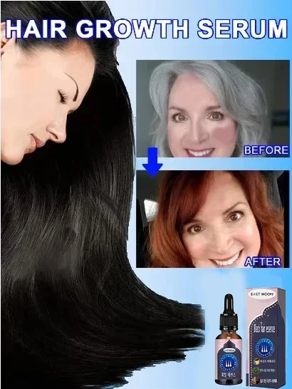 White hair killer, remove gray hair and restore natural color in 7 days