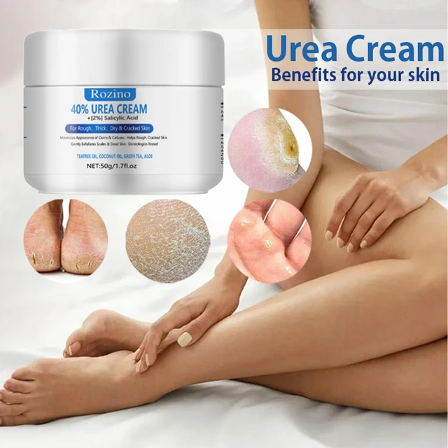 Urea Cream 20 Percent For Feet Plus 2% Salicylic Sri Lanka | Ubuy
