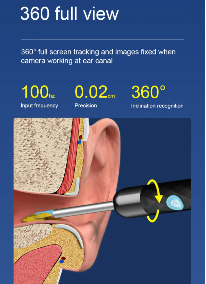 Outil d'élimination du cérumen, nettoyeur d'oreilles avec caméra 1080p, kit  de nettoyage d'oreille avec ensemble d'oreilles 8 Pcs, dissolvant de cérumen  avec lumière, endoscope avec accès auxiliaire 5