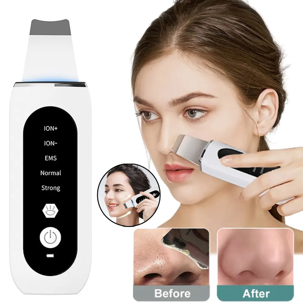 UltrasonicSkinScrubberPeelingBlackheadRemoverDeepFaceCleaning