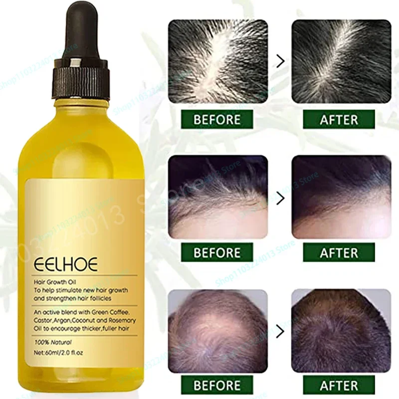 Strong Effect Hair Growth Products Ginger Essential Oil 2 Week Treat Hair Loss Scalp Repair Nourish Hair Roots Regrowth