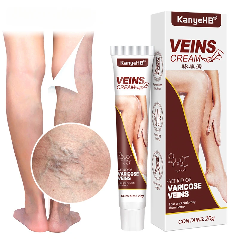 Varicose Vein Relief Cream Vasculitis Phlebitis Spider Legs Treatment Soothing Relieve Pain Herbal Ointment