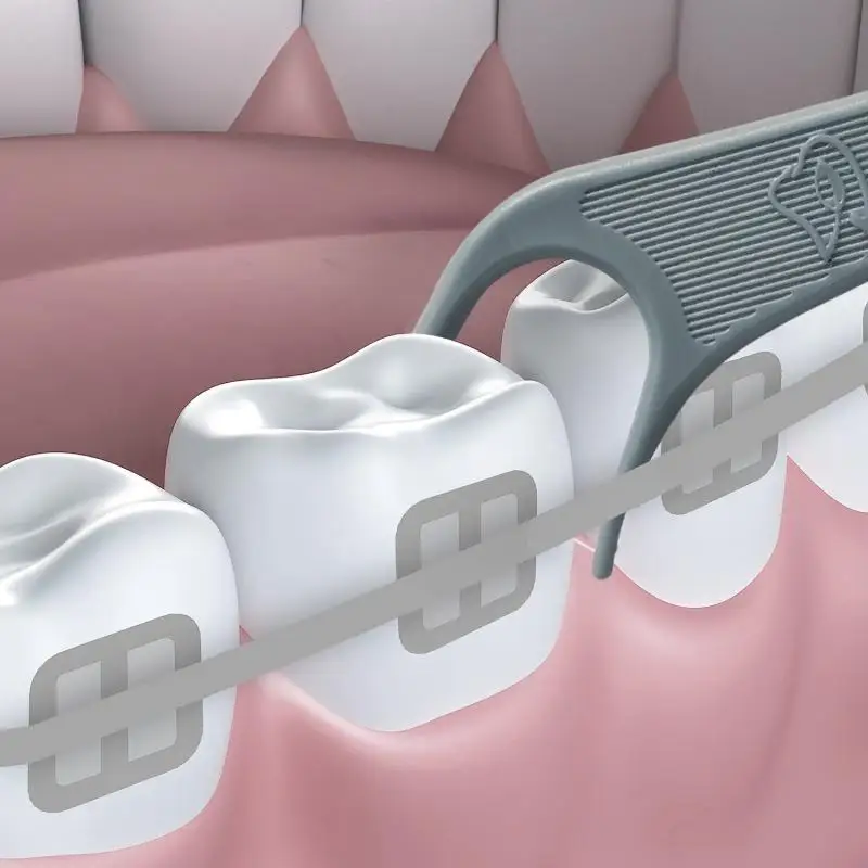 60 יחידות חדשות של פלוסים אורתודונטיים למתיחת שיניים, חוטי שיניים אורתודונטיים, חוטי שיניים בין שיניים למבוגרים וילדים