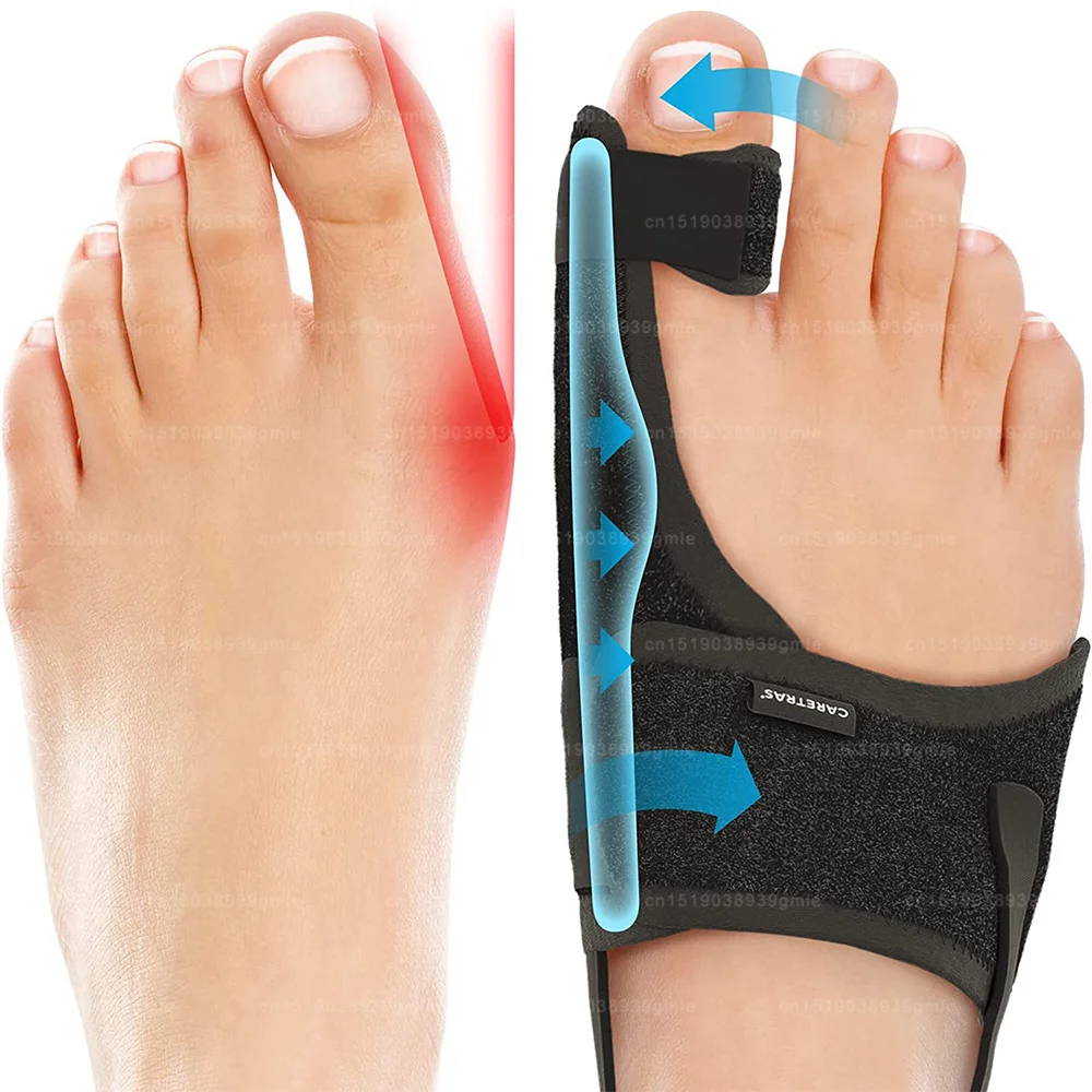 Hallux Valgus Correction Foot Corrector Bunion Splint Big Toe Straightener Orthopedic Corrector Pedicure Bunion Protector Toes toe corrector