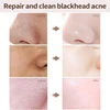Salicylic Acid Pores Shrink Cream Refining Large Pore Improve Face Acnes Blackhead Remove Cream Anti-aging Oil Control Skin Care 3