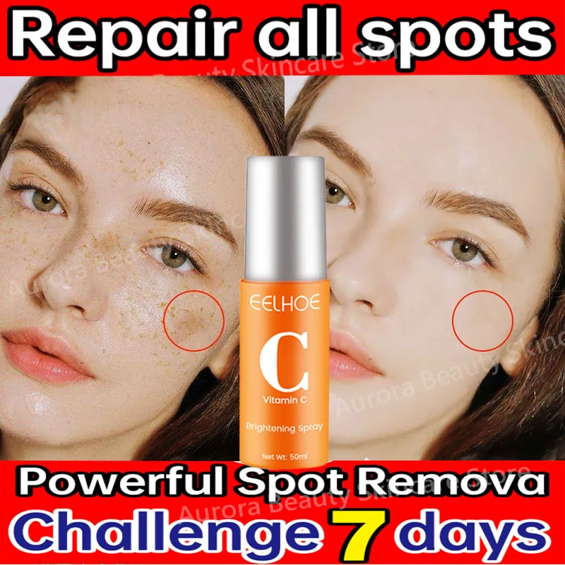 Siero viso sbiancante per lentiggini alla vitamina C Rimuovi le macchie scure Dissolvenza Melasma Anti-età Illumina Tonico idratante all'essenza_voghion.com