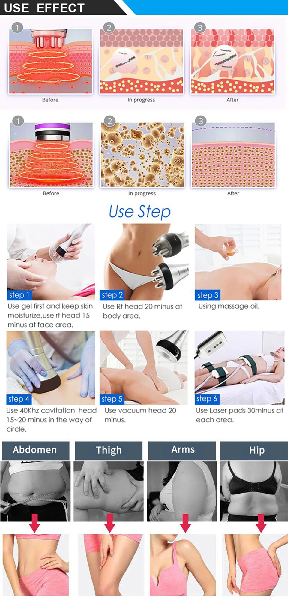 Ultraschall 40k Kavitation maschine Vakuum Gewichts verlust Körper Schlankheit gerät Anti-Cellulite Fat burner Massage – Detail 8
