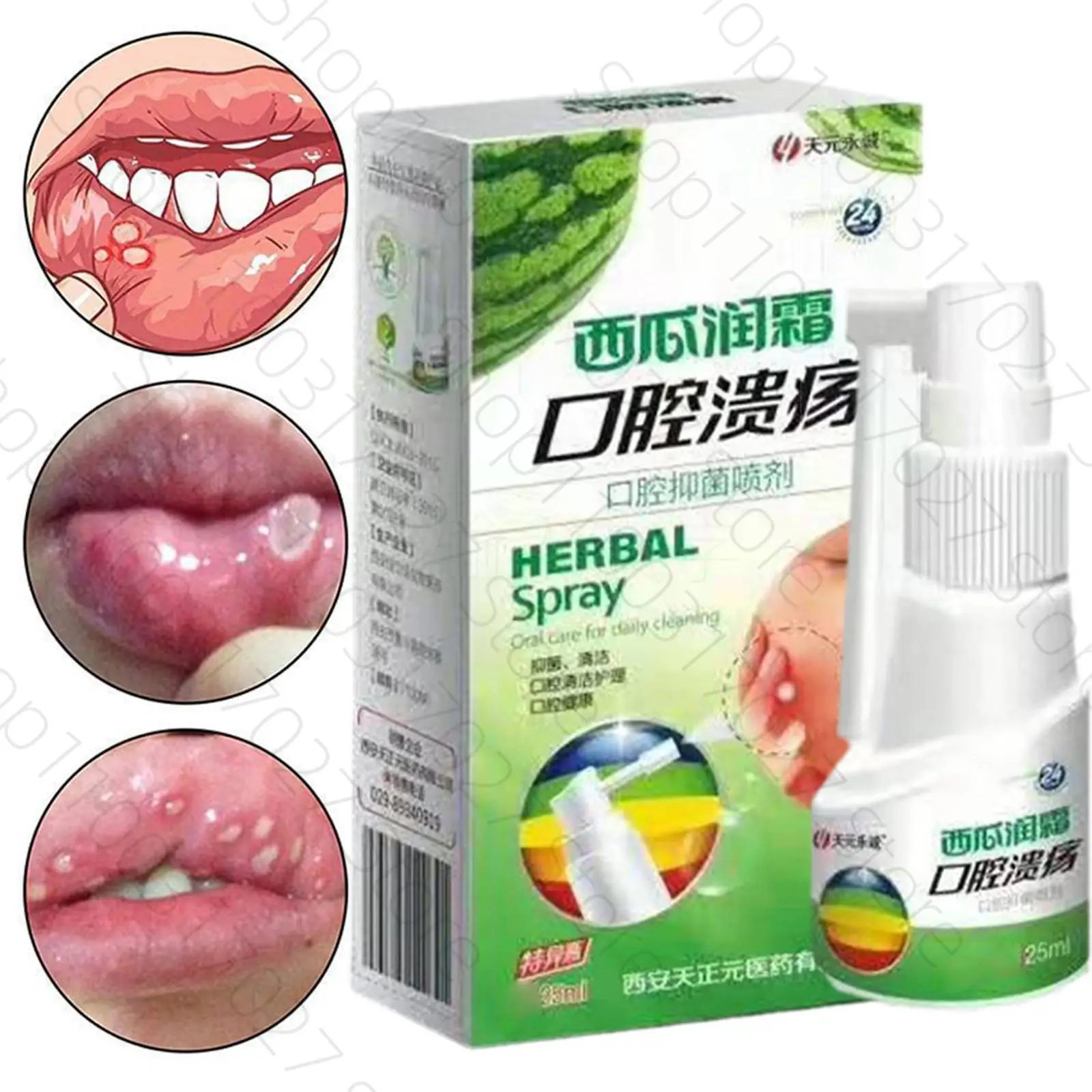 Herbal Oral Spray Watermelon Cream Antibacterial Spray Ulcer Pain Relief Spray Antibacterial Treatment Health Care Fresh Breath