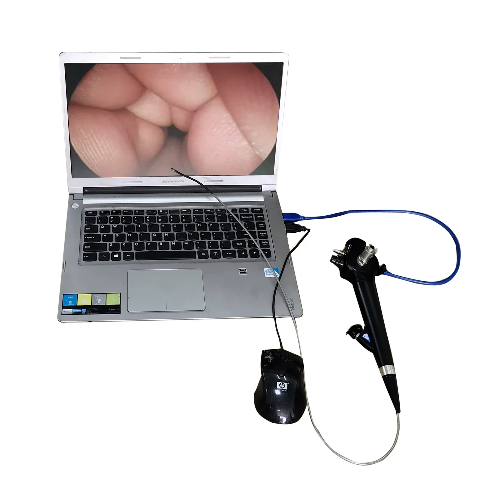 Рисунок 2 - Портативный видео гибкий гастроскоп